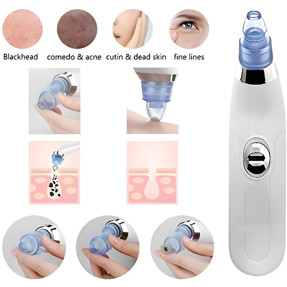 ⭐ Pore Cleaning Device – Deep Clean for Smooth & Clear Skin