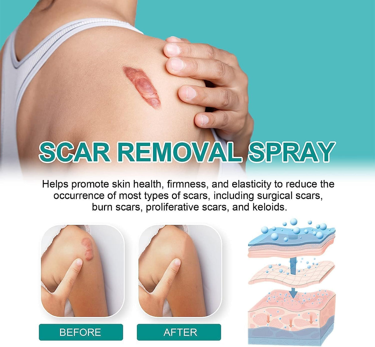 South Moon - Scar Spray
