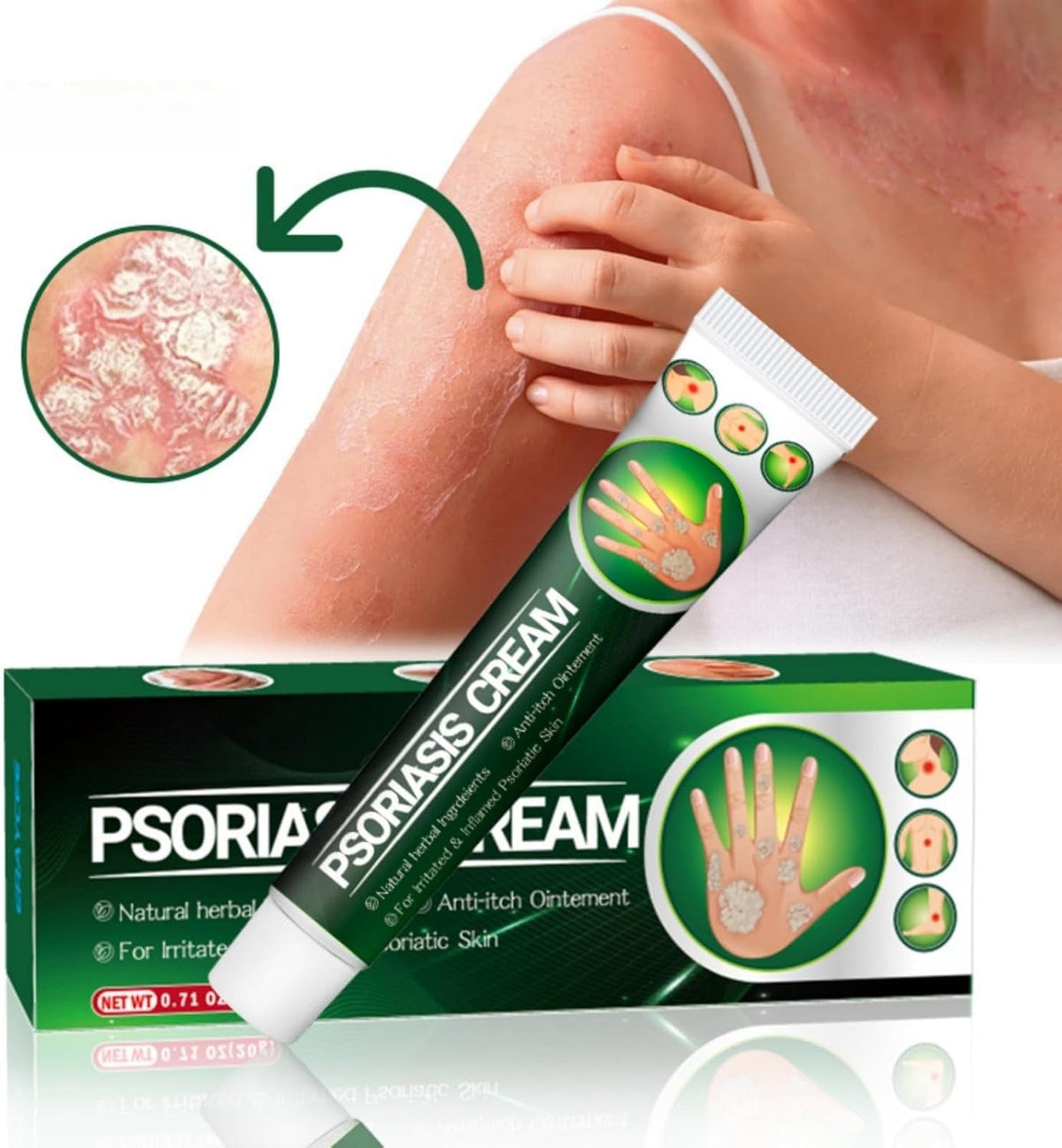 Psoriasis Cream (Original) – 20g