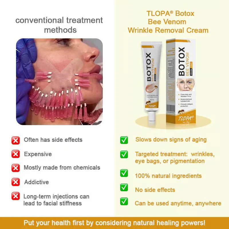 Botox Bee Venom Wrinkle Removal Cream